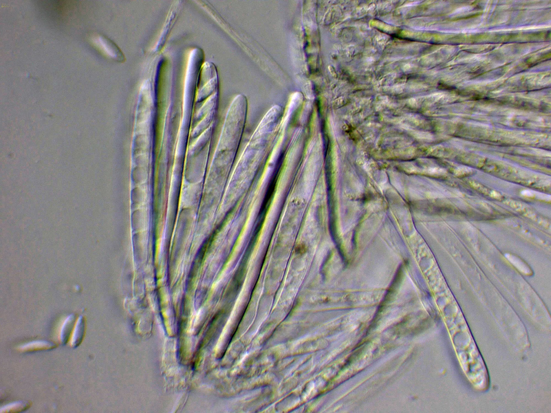 Microscopía de Tapesia lividofusca - 10 - Ascos agua-002